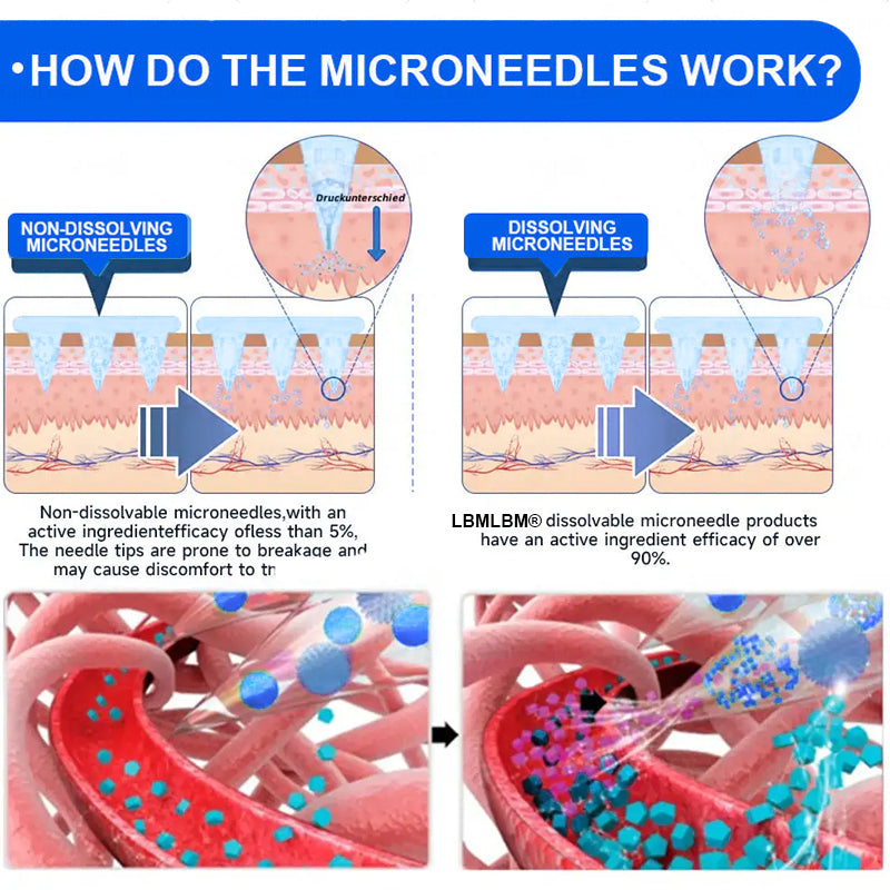 Official Store | LBMLBM® SMGT-GLP-1 Nano Microneedle Patch with Collagen & Matrixyl 3000