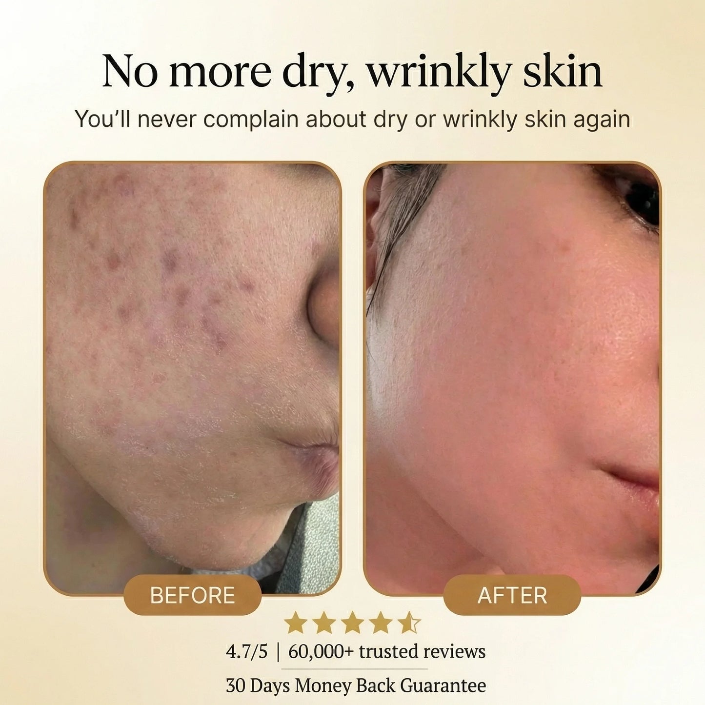 Tallow Honey Balm to Help Erase Fine Lines, Wrinkles, and Age Spots