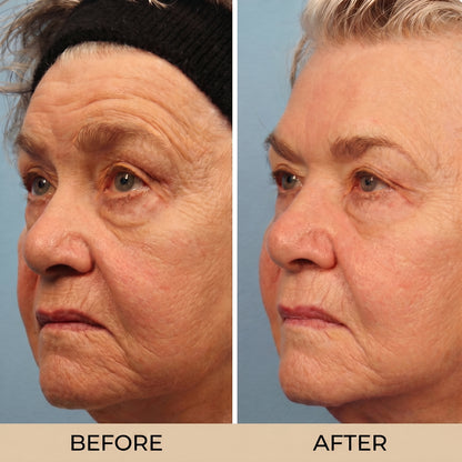 Tallow Honey Balm to Help Erase Fine Lines, Wrinkles, and Age Spots