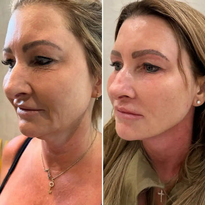 Tallow Honey Balm to Help Erase Fine Lines, Wrinkles, and Age Spots