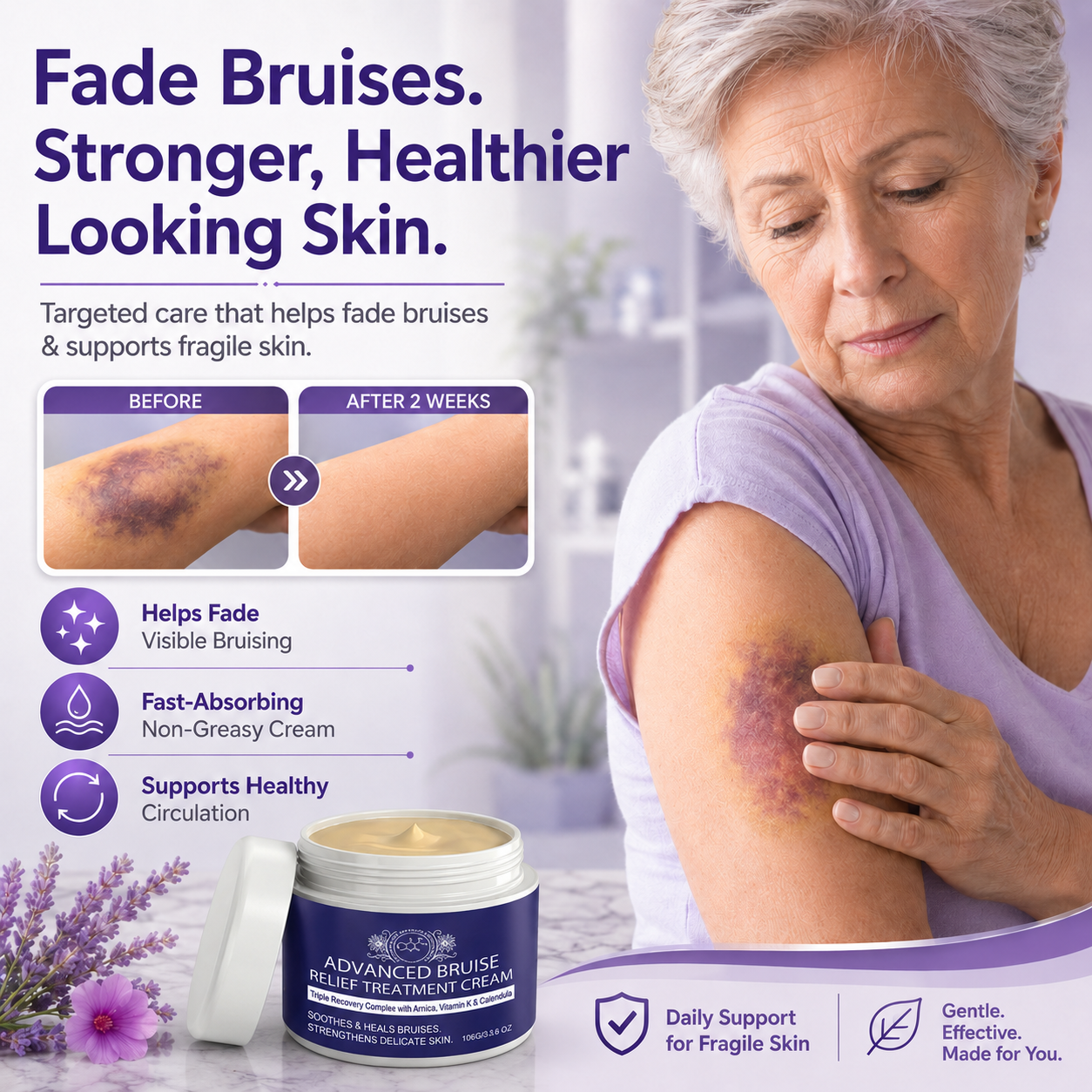 💥75K+ SOLD💕- Bruise Repair & Skin-Strengthening Cream